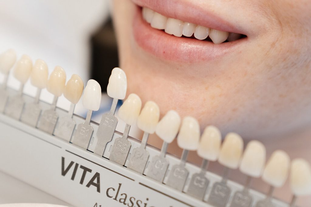 ugradnja implantata, implantologija, stomatološka ordinacija