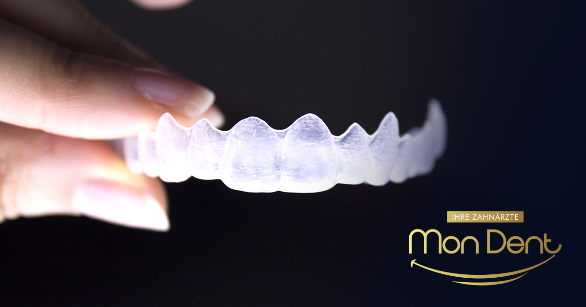 Bruksizam – uzroci, simptomi i liječenje