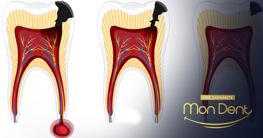 cista na zubu, stomatološka klinika